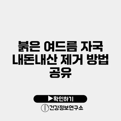 붉은 여드름 자국 내돈내산 제거 방법 공유