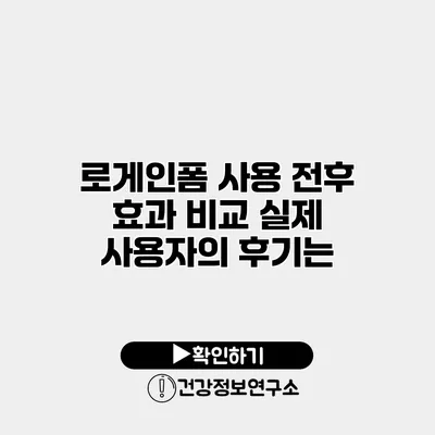 로게인폼 사용 전후 효과 비교 실제 사용자의 후기는?