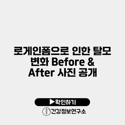 로게인폼으로 인한 탈모 변화 Before & After 사진 공개