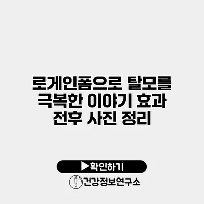 로게인폼으로 탈모를 극복한 이야기 효과 전후 사진 정리